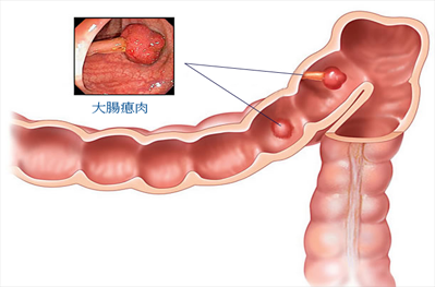 点击咨询