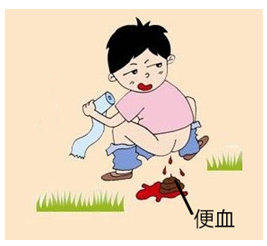 说明: 便血