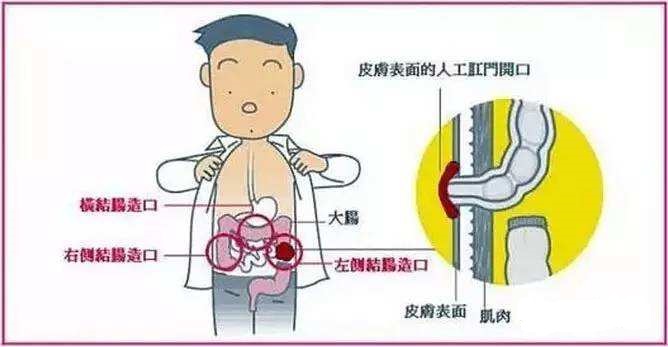 广州痔疮医院