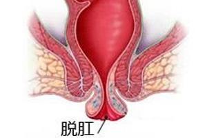 广州痔疮医院哪家好