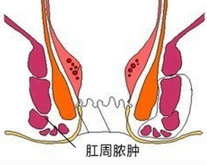 广州东大肛肠医院怎么样