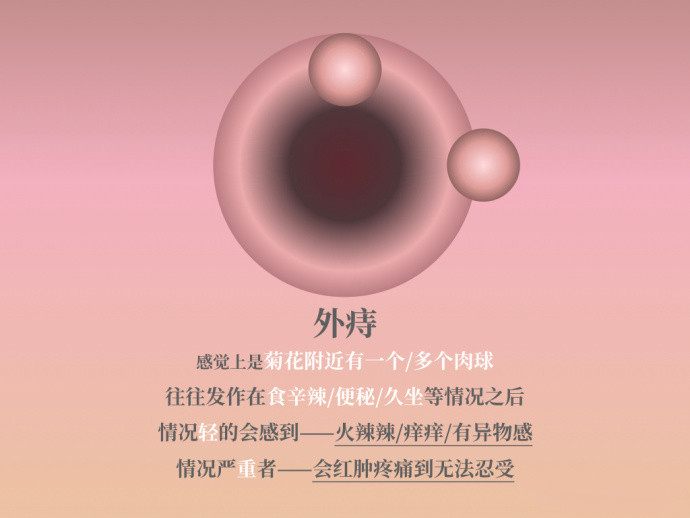 广州东大肛肠医院费用贵吗